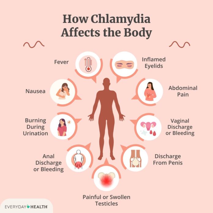 A Comprehensive Guide to Chlamydia Symptoms